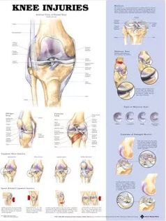Knee Injuries Anatomical Chart (Indbundet, 2003)