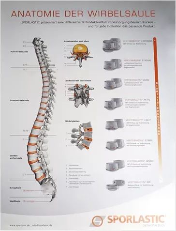 Sporlastic anatomisk plakat - ryg, 59,4 x 84,1 cm
